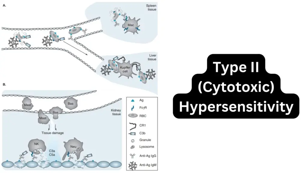 Type II (Cytotoxic) Hypersensitivity - Definition, Mechanism, Examples ...