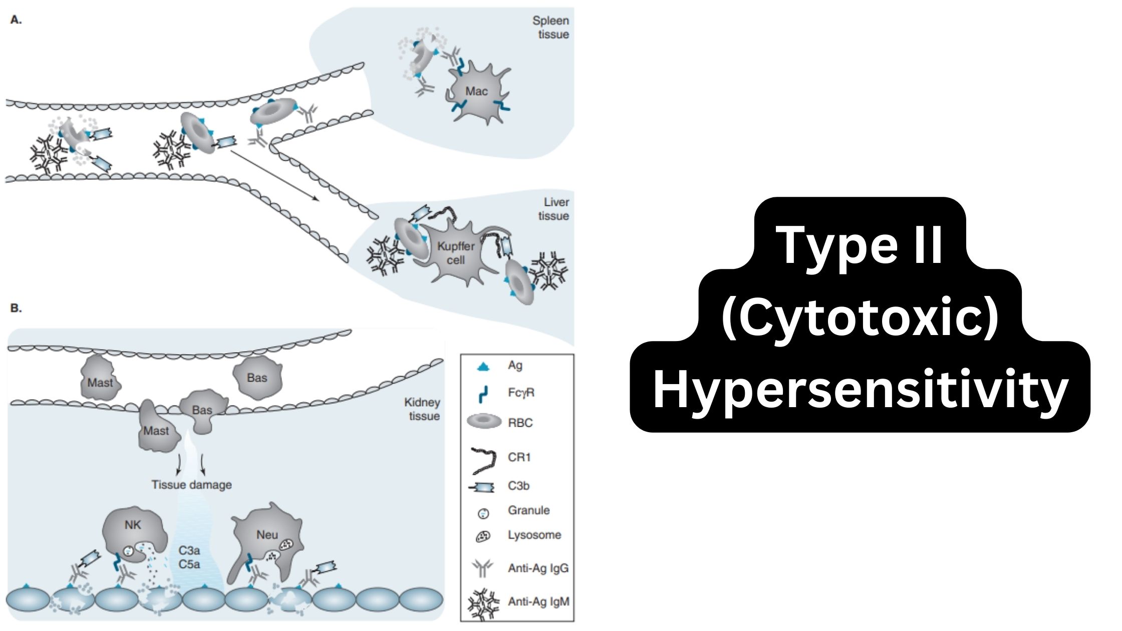 Type II (Cytotoxic) Hypersensitivity - Definition, Mechanism, Examples