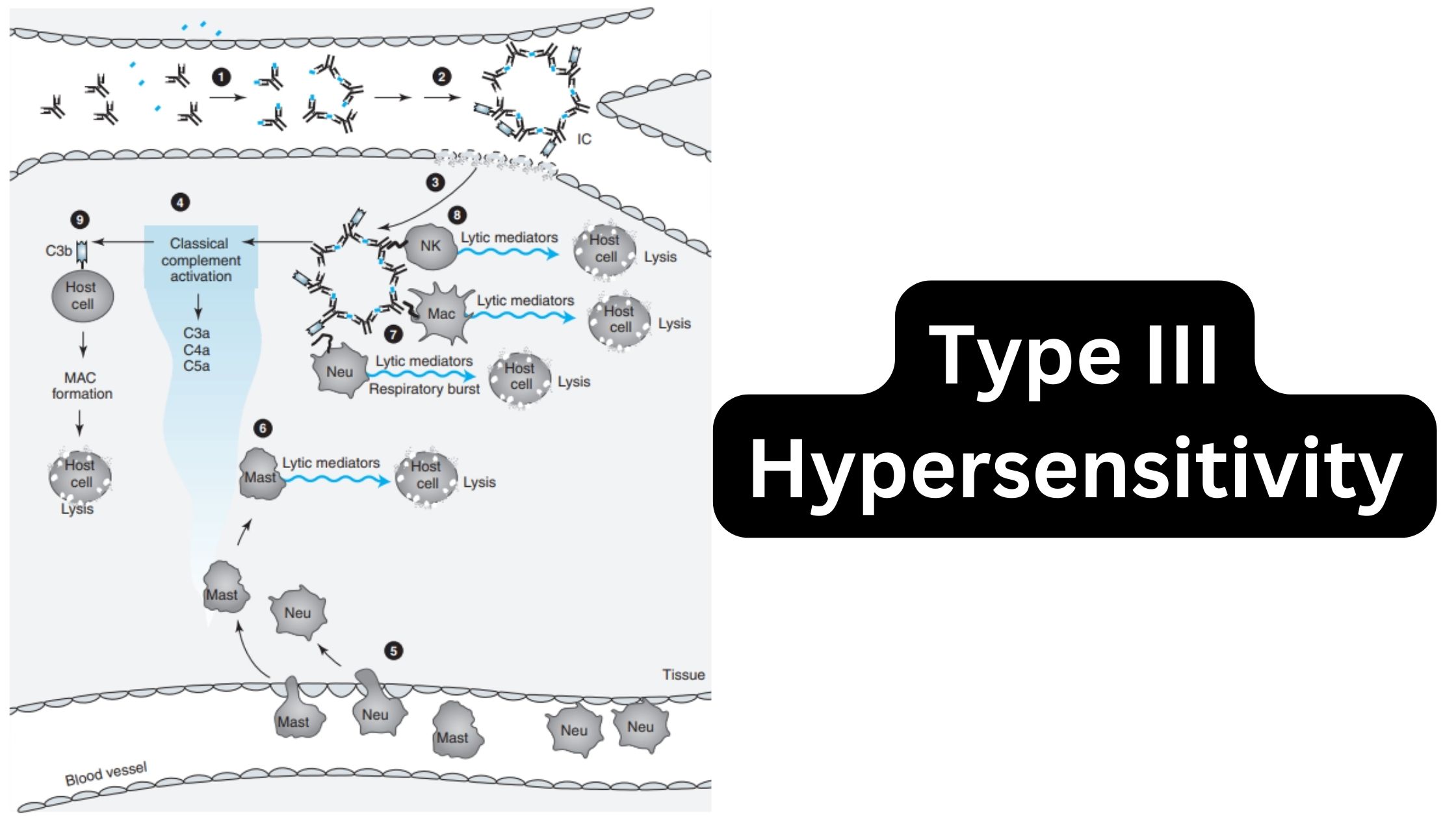 Type III Hypersensitivity - Definition, Types, Mechanism, Examples