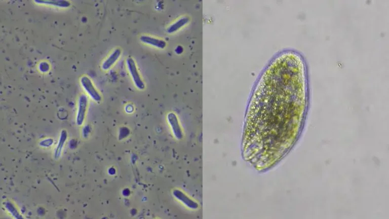 Types of Microorganisms In Pond Water