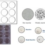 Venereal Disease Research Laboratory (VDRL) Test