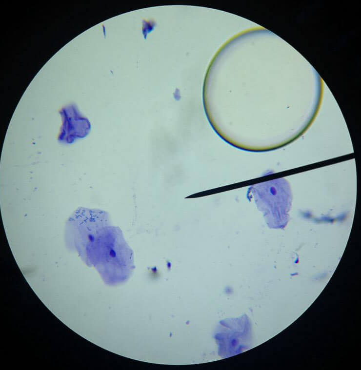 Cheek Cells Under a Microscope - Biology Notes Online