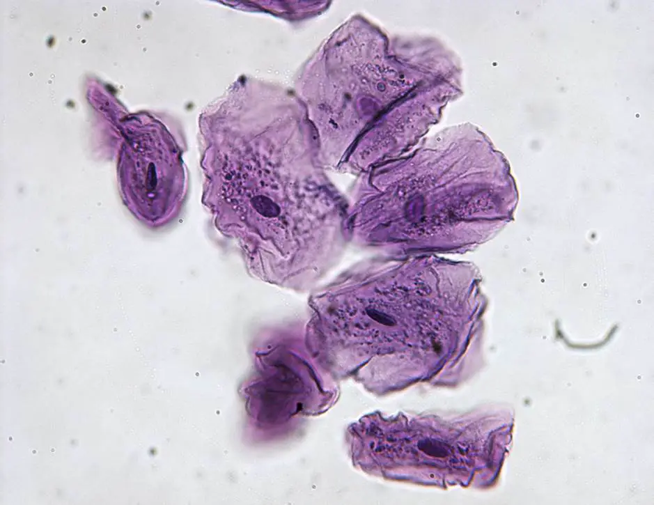 Cheek Cells Under A Microscope Biology Notes Online Cheek Cells Under A Microscope Biology Notes Online