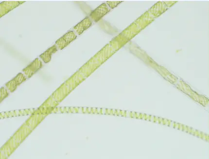 Spirogyra