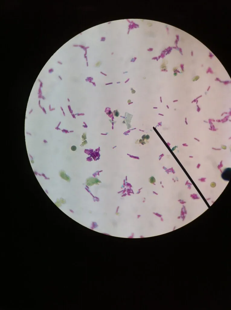 View of E. coli under the microscope after Gram Staining.