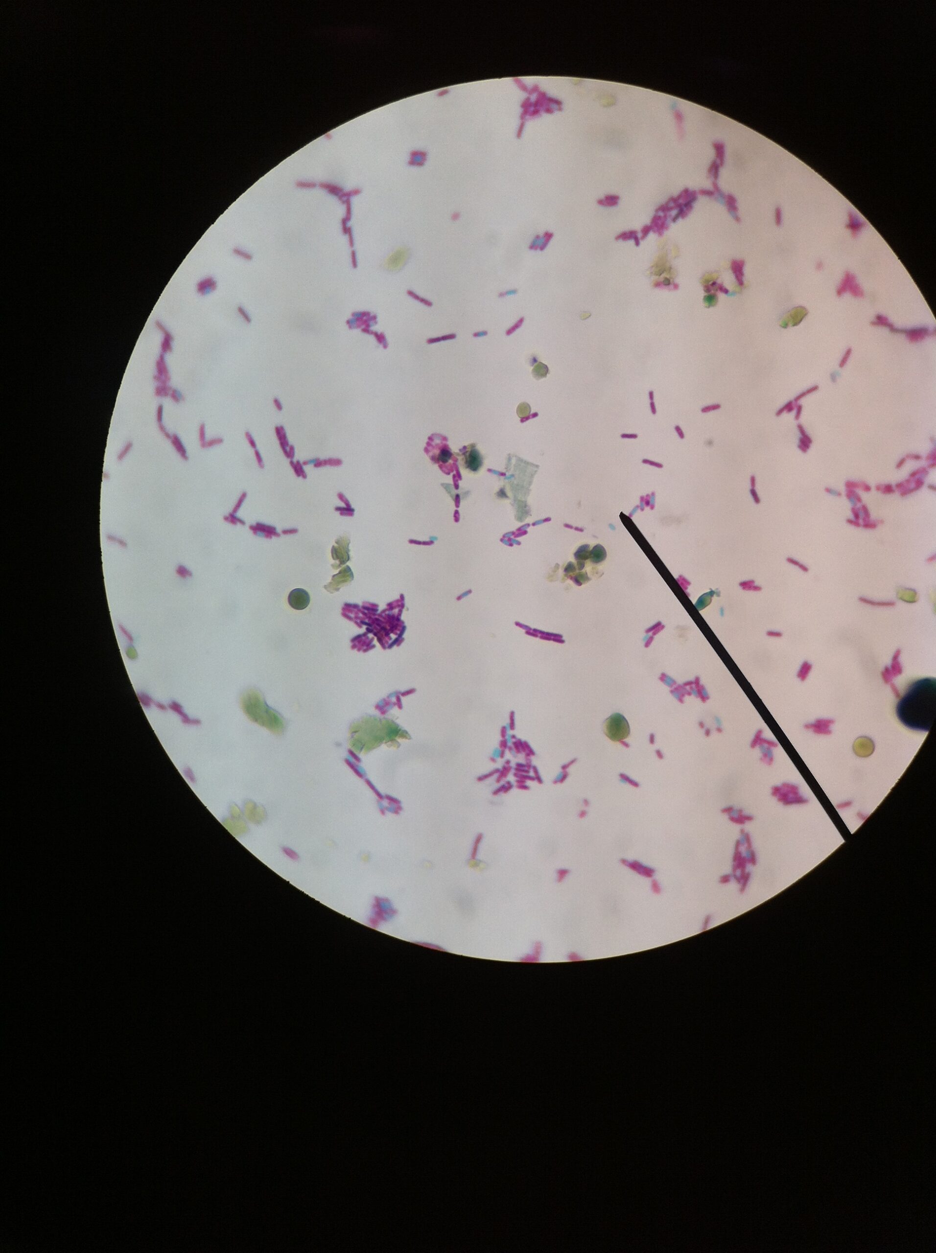 E. Coli Under The Microscope - Biology Notes Online