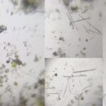 Diatoms Under the Microscope