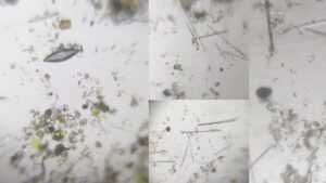 Diatoms Under the Microscope