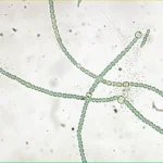 Anabaena Under Microscope