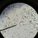 Termite Guts with Trichonympha