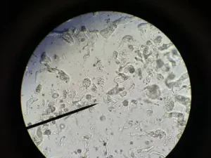 Trichonympha Under Microscope
