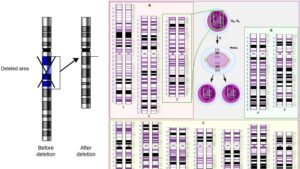 Deletion Mutation – Definition, Causes, Mechanism, Examples