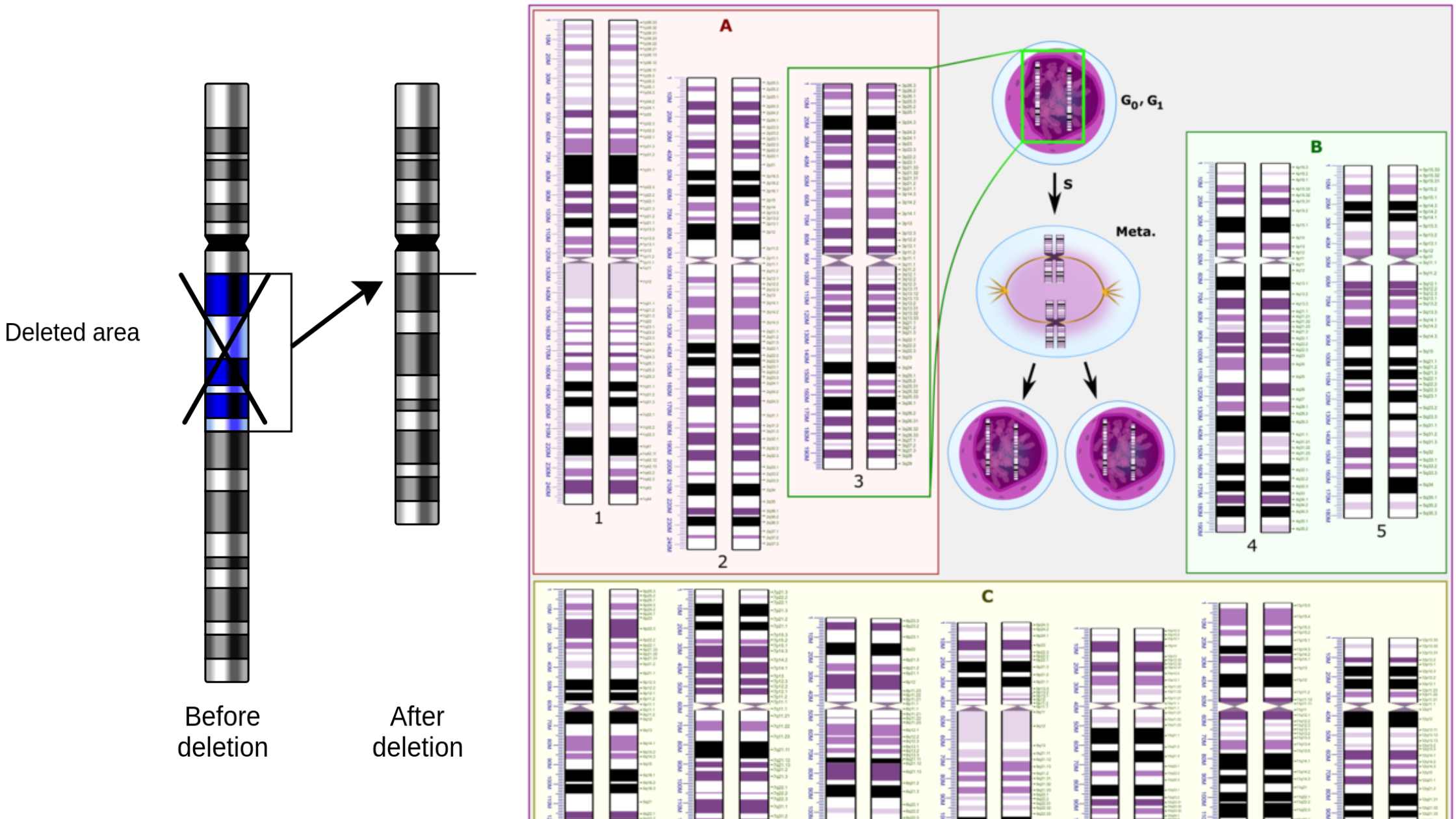 Deletion Mutation - Definition, Causes, Mechanism, Examples