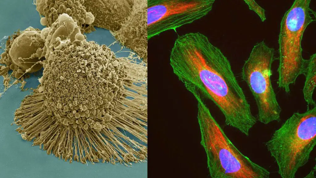 HeLa Cells - Definition, Characteristics, Significance, Applications ...