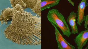 HeLa Cells – Definition, Characteristics, Significance, Applications