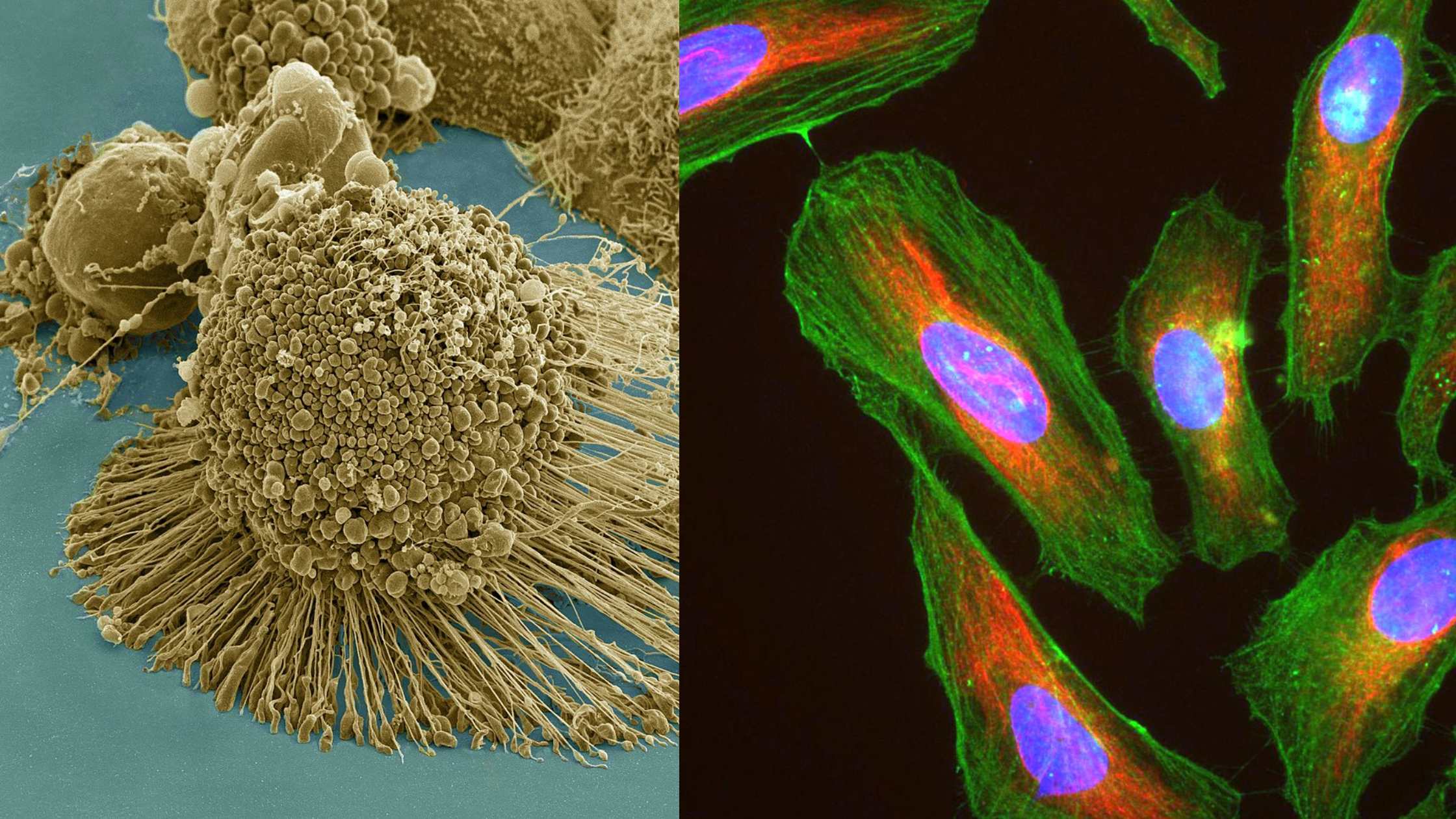 HeLa Cells - Definition, Characteristics, Significance, Applications