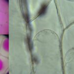 Plasmolysis - Definition, Stages, Functions, Examples,