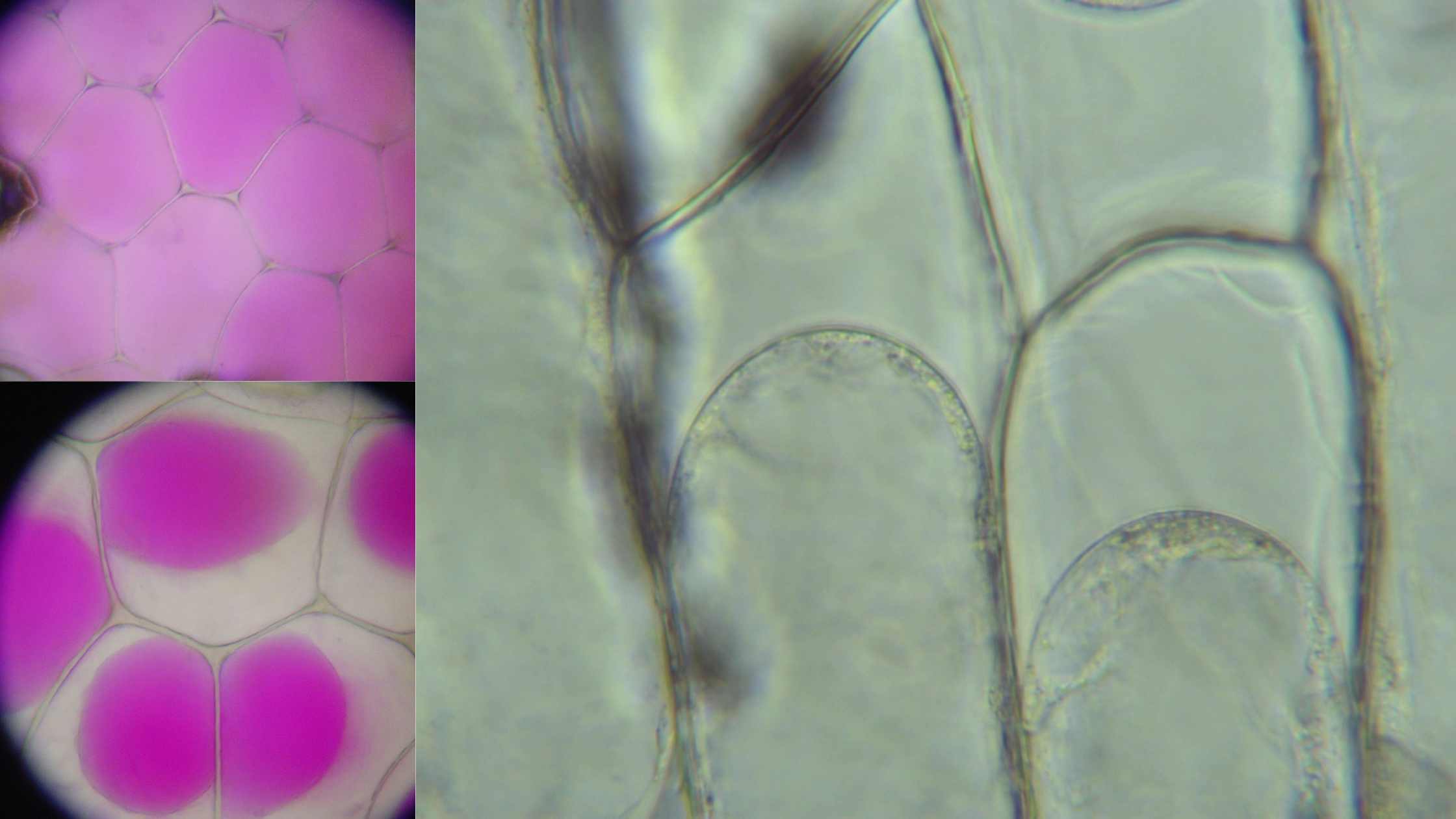 Plasmolysis - Definition, Stages, Functions, Examples,