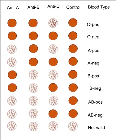 Common Blood Group Systems