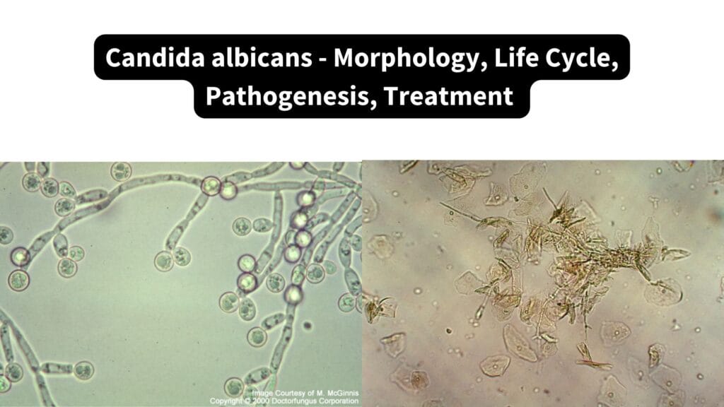 Fungi Definition Characteristics Morphology Importance Examples Fungi Definition Characteristics Morphology Importance Examples