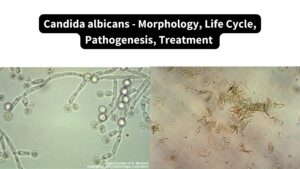 Candida albicans – Morphology, Life Cycle, Pathogenesis, Treatment