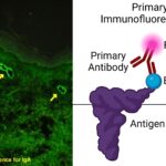 Immunofluorescence Assay - Principle, Protocol, Types, Uses