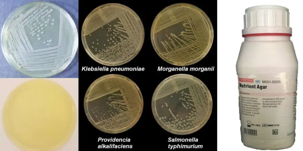 Nutrient Agar - Principle, Composition, Preparation, Results, Uses 