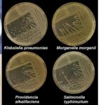 Nutrient Agar - Principle, Composition, Preparation, Results, Uses
