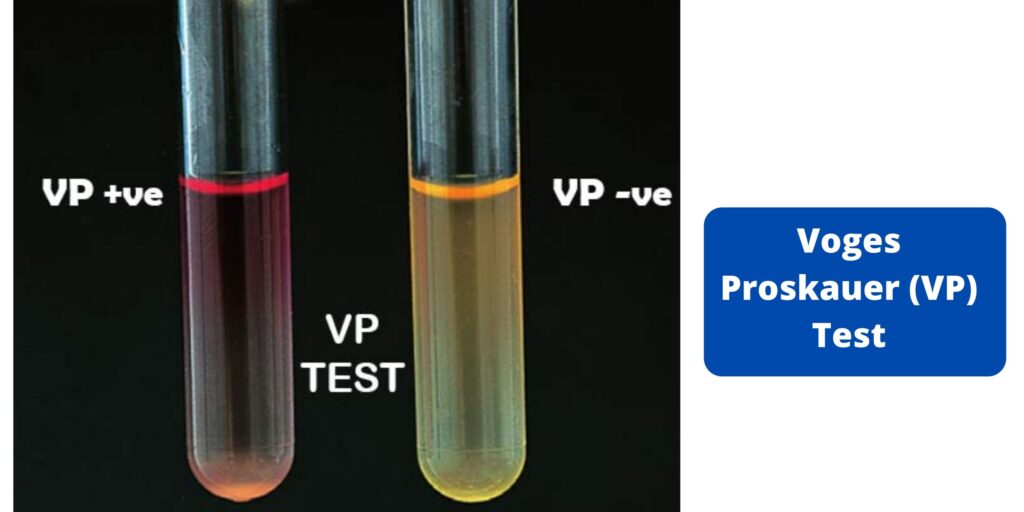 Voges Proskauer (VP) Test - Principle, Procedure, Results - Biology ...