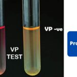 Voges Proskauer (VP) Test - Principle, Procedure, Results