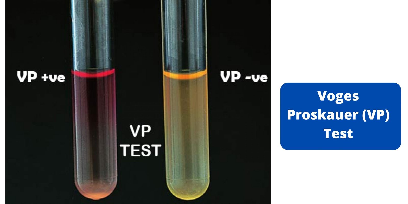 Voges Proskauer (VP) Test - Principle, Procedure, Results