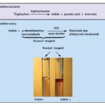 Indole Test - Principle, Procedure, Result, Uses
