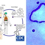 Loa loa Life cycle, Morphology, Pathogenesis, Diagnosis, Transmission, Treatment