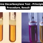 Ornithine Decarboxylase Test - Principle, Procedure, Result