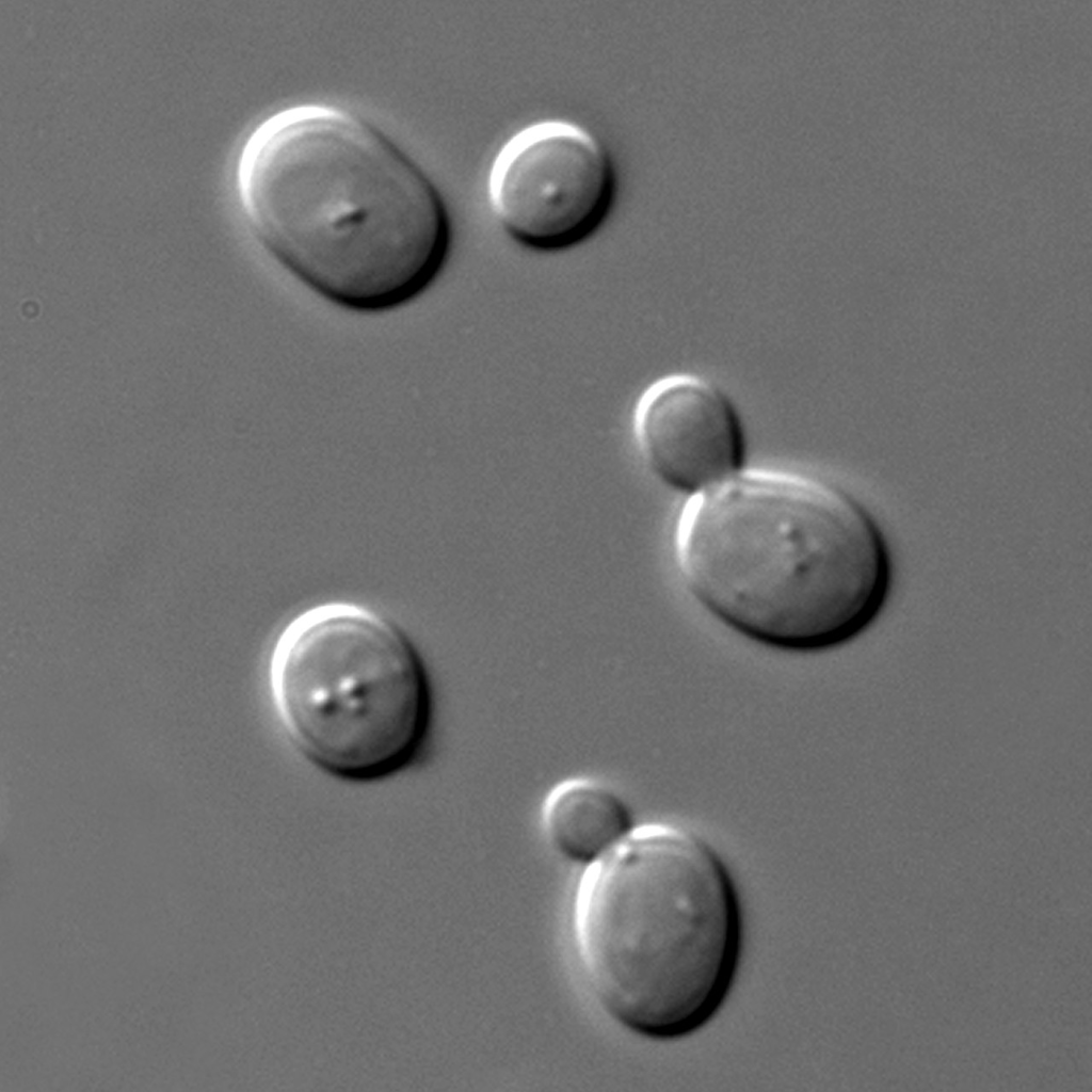Saccharomyces cerevisiae cells in DIC microscopy.