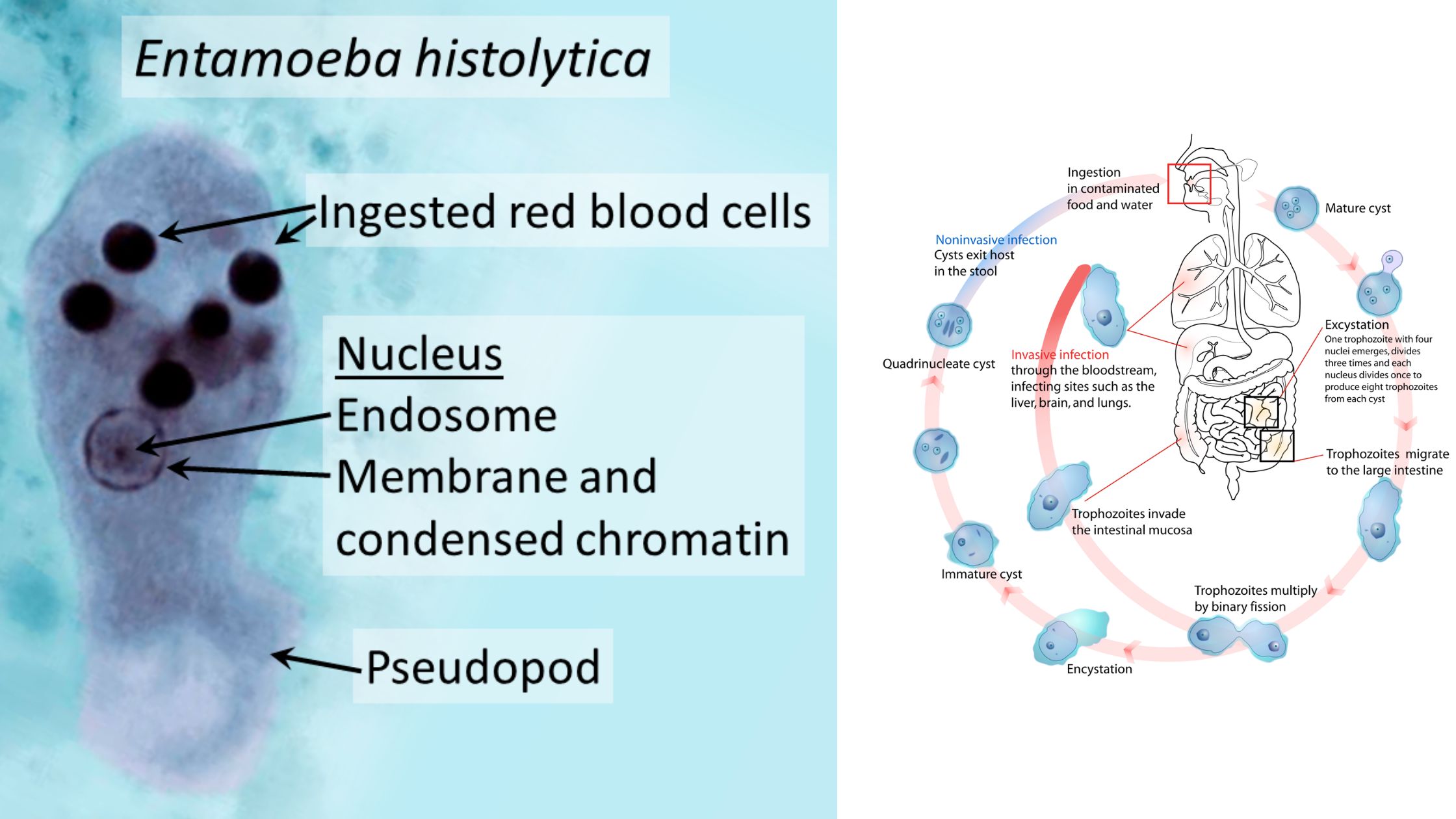 Amoebiasis, Entamoeba Histolytica, Life cycle, Diagnosis