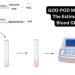 GOD-POD Method For The Estimation Of Blood Glucose