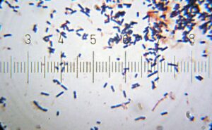 Lactobacillus acidophilus – Definition, Morphology, Classification, Habitat