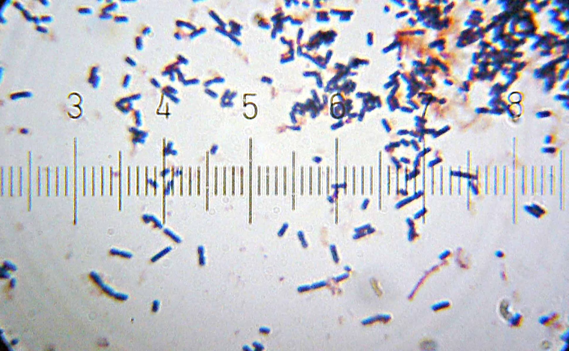 Lactobacillus acidophilus - Definition, Morphology, Classification, Habitat