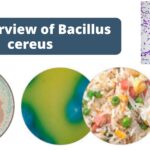 An Overview of Bacillus cereus