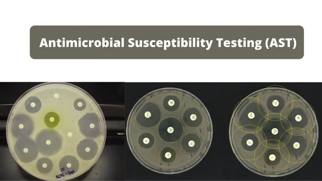 Antimicrobial Susceptibility Testing (AST) - Biology Notes Online