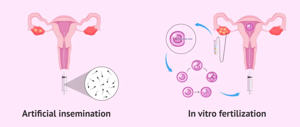 Assisted Reproductive Technology - Techniques, Importance - Biology ...