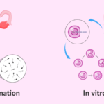 Assisted Reproductive Technology - Techniques, Importance