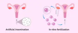 Assisted Reproductive Technology – Techniques, Importance
