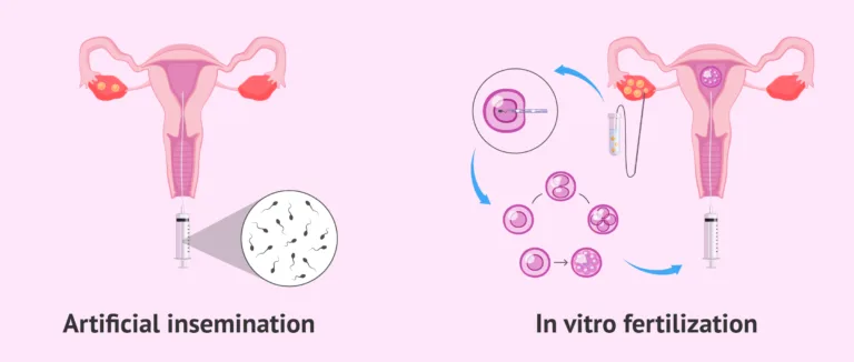 Assisted Reproductive Technology - Techniques, Importance