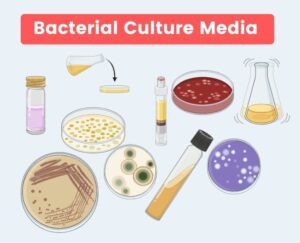 Culture Medium – Definition, Preparation, Classification