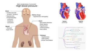 Blood Pressure – Definition, Types, Measurement, Disorders