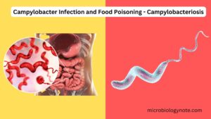 Campylobacter Infection and Food Poisoning – Campylobacteriosis