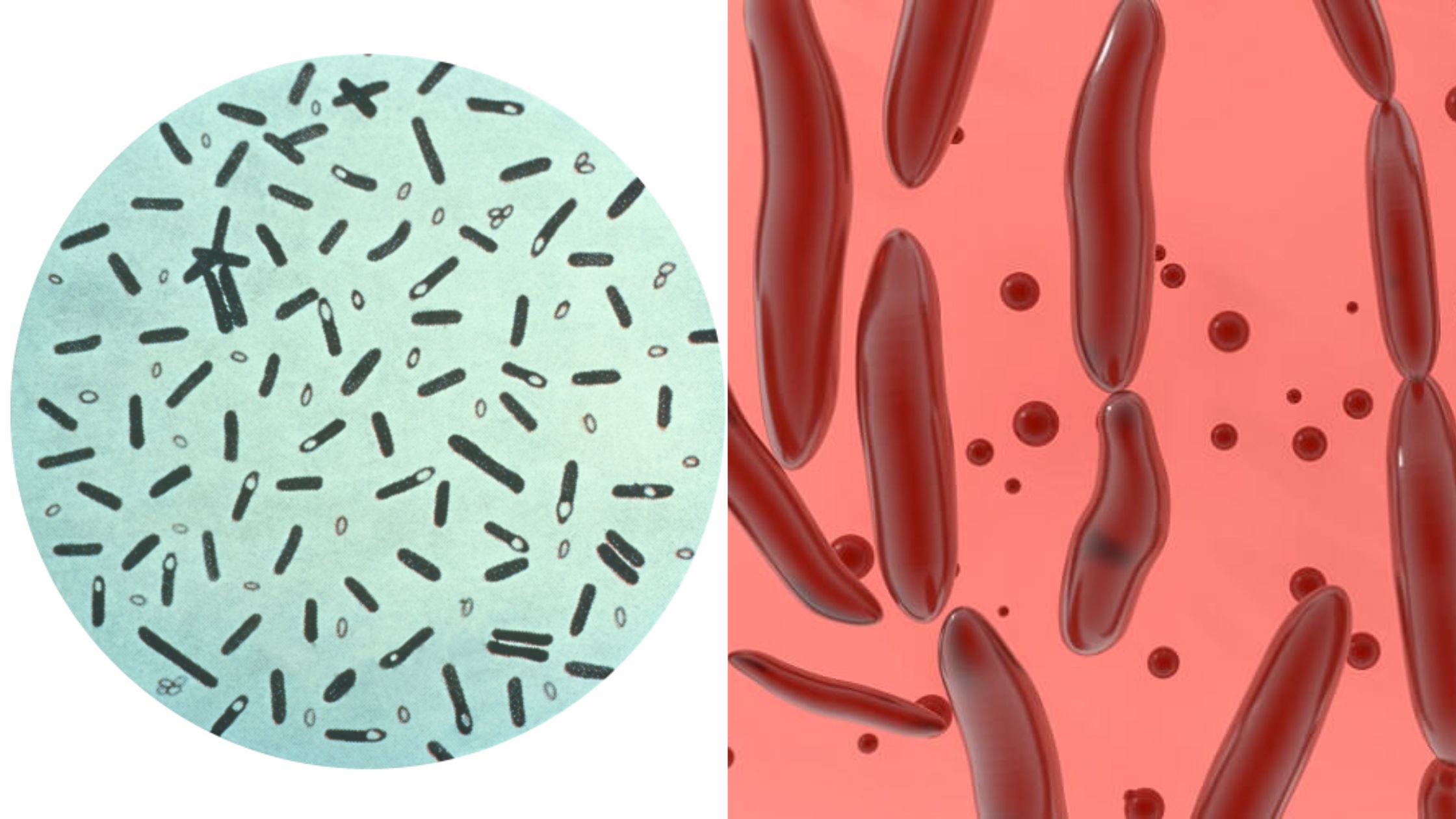 Clostridium botulinum - Overview