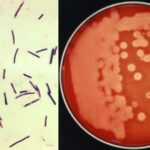 Clostridium perfringens 